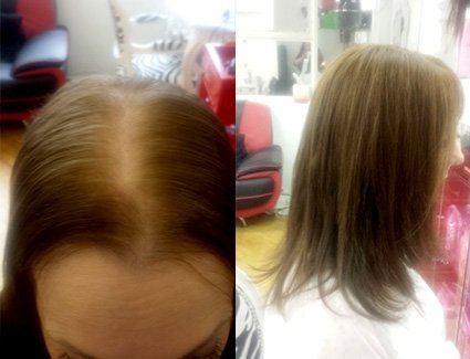 womens hair replacement systems