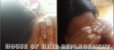 client before and after frontal integration