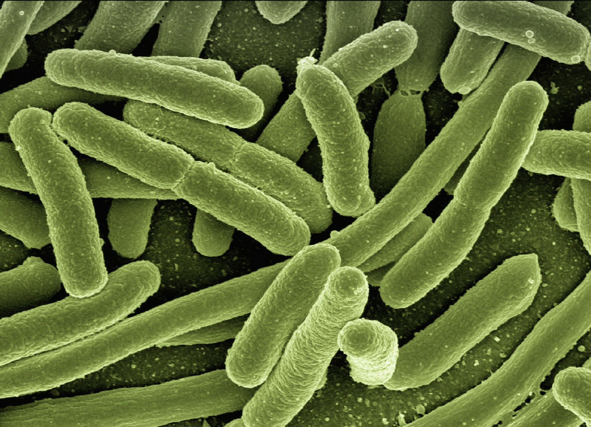 What Are The Dangers Of Legionella Image