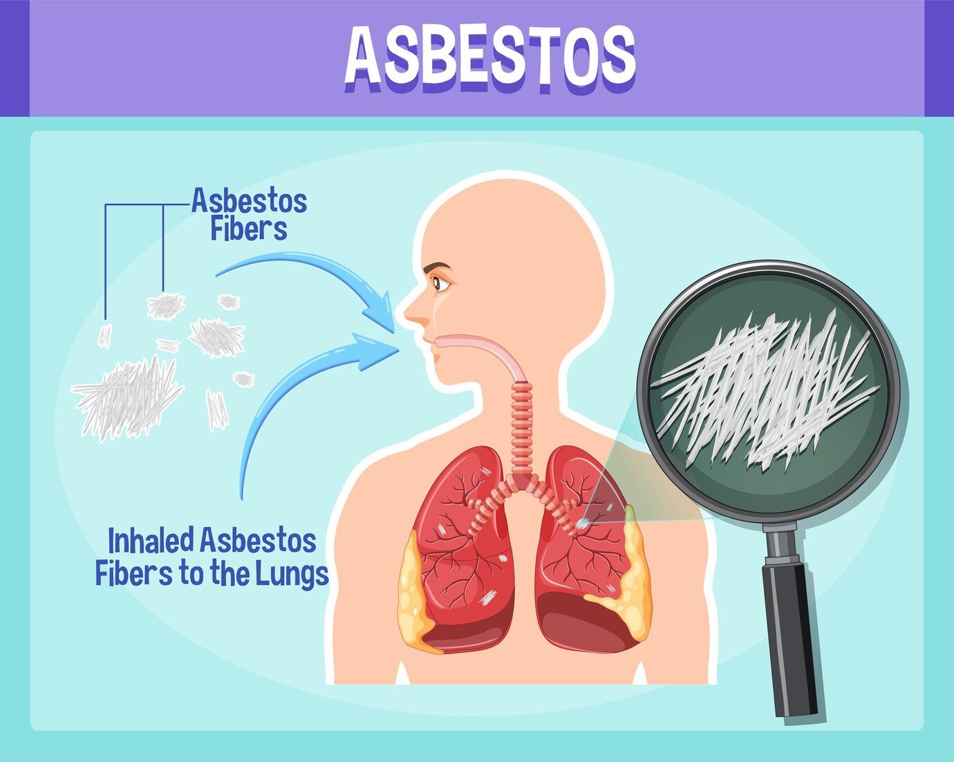 How Long Does It Take For Asbestos To Affect You?